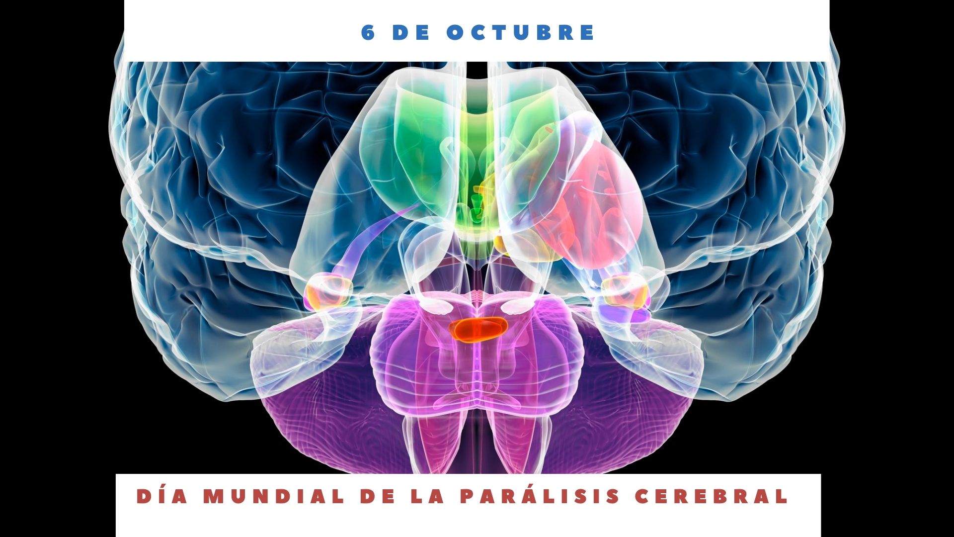 DÍA MUNDIAL DE LA PARÁLISIS CEREBRAL 6 de octubre Día Internacional Hoy